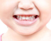 Obavezno lečite mlečne zube