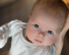 Krivi vrat kod beba: Koji su uzroci, kako se prepoznaje, a kako leči tortikolis?