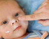Atopijski dermatitis kod beba i kako ga lečiti