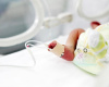 Hitna hirurgija kod novorođenčadi: Koje urođene anomalije se operišu odmah nakon rođenja?
