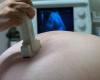 Ultrazvuk - gde je granica?