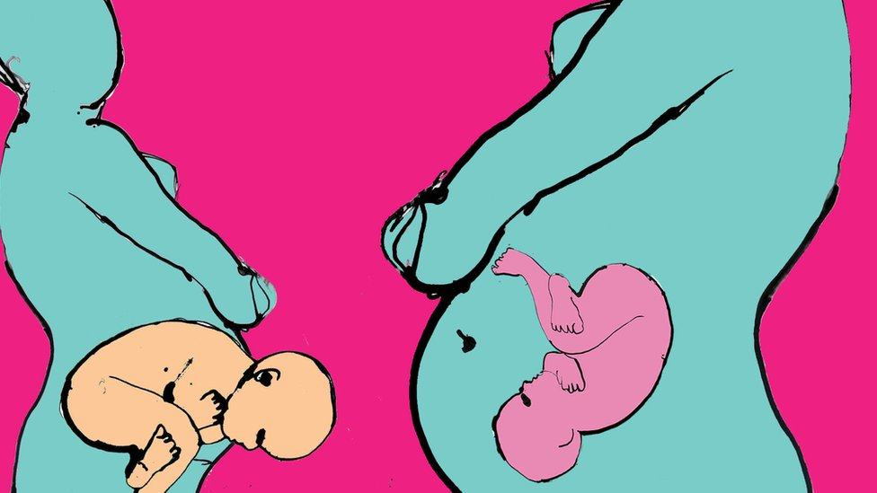 Carski rez ili prirodni porođaj: Kako način rođenja utiče na zdravlje beba