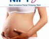Novine u kontroli trudnoće “NIFTY” ( Non-Invasive Fetal Trisomy Test )