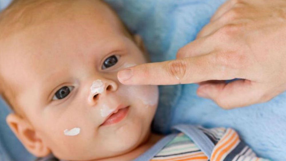 Atopijski dermatitis kod beba i kako ga lečiti