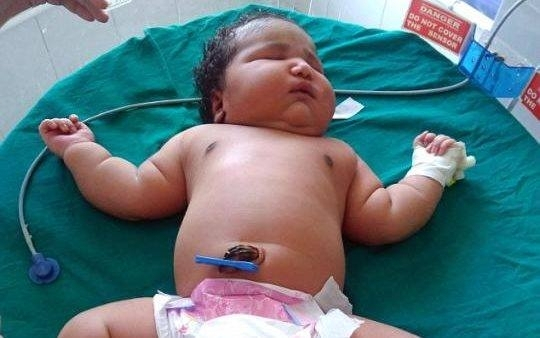 Devetnaestogodišnja devojka rodila bebu tešku 6,8 kilograma